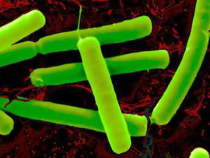 Что это такое анаэробные бактерии и анаэробные инфекции