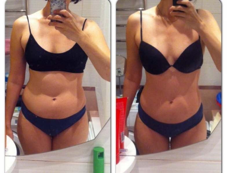 Душ Шарко для похудения — фото до и после