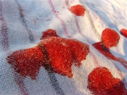 									Как вывести застарелые пятна крови с одежды или мебели								